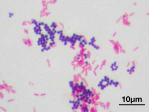 Gram-color Stain set for the Gram staining method