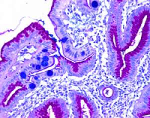Pararosaniline (chloride) (C.I. 42500) for microscopy Certistain®