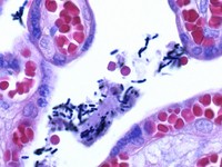 Gram's crystal violet solution  for the Gram staining method