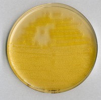 Pseudomonas agar F (base) for microbiology Merck