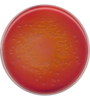 MacCONKEY agar for the isolation of Salmonella, Shigella and coliform bacteria (According harm. EP/USP/JP) 5kg Merck