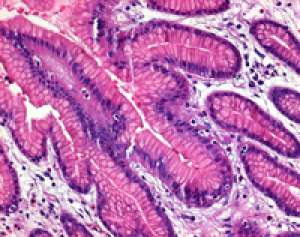 Eosin Y (yellowish) (C.I. 45380) for microscopy Certistain® 25g Merck