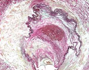 Elastica van Gieson staining kit for connective tissue Merck