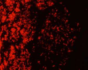 Rhodamine B (C.I.45170) for microscopy 100g Merck