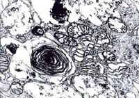 Glutardialdehyde solution 25% for electron microscopy 1l Merck