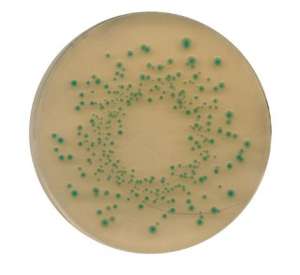 TBX (Tryptone Bile X-glucuronide) agar Merck