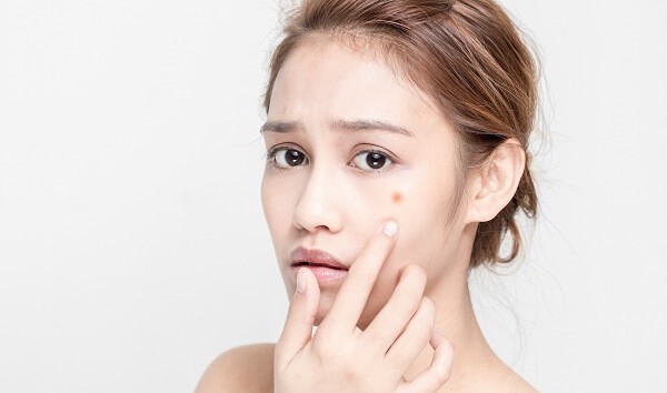 Glycerin có công dụng ngăn ngừa mụn trứng cá