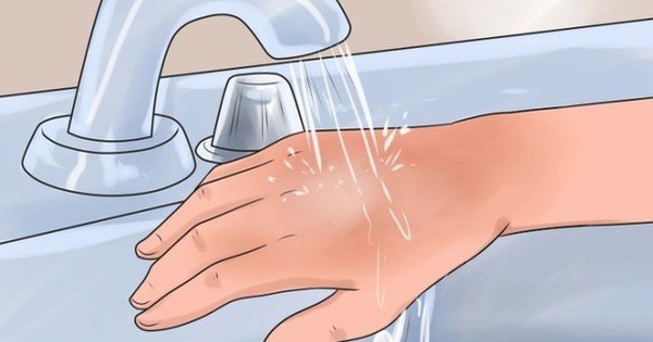 Nếu AgNO3 tiếp xúc với da cần phải rửa lại da nhiều lần bằng nước sạch