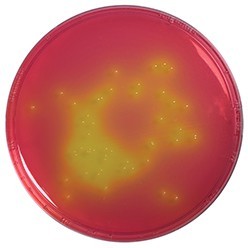 Mannitol salt phenol-red agar Merck | 1054040500