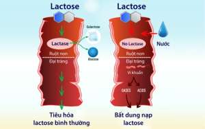 lactase-medium